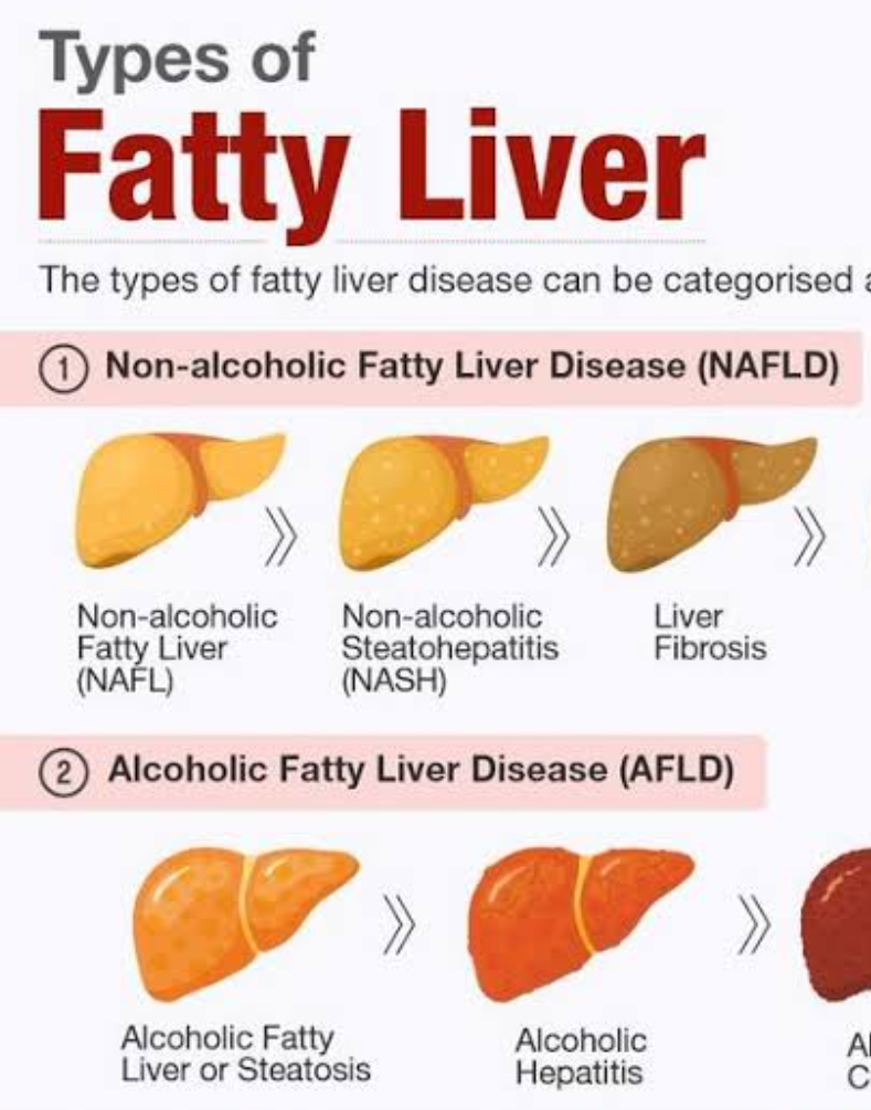 Cold Drink Peene Ke Kya Nuksan Hai