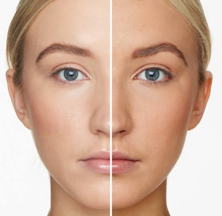 How To Remove Body Tanning