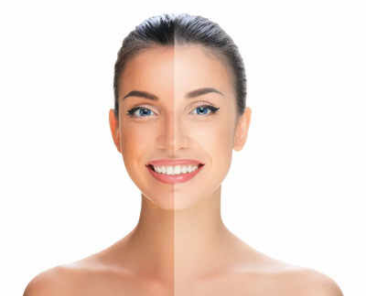 How To Remove Body Tanning